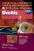 Uveitis