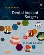 Color Atlas of Dental Implant Surgery