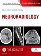 Neuroradiology: The Requisites