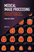 Medical Image Processing: Advanced Fuzzy Set Theoretic Techniques