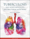 Tuberculosis and Nontuberculous Mycobacterial Infections