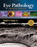 Eye pathology: an atlas and text