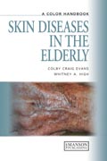 Skin diseases in the elderly