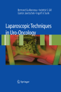 Laparoscopic techniques in uro-oncology