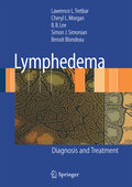 Lymphedema: diagnosis and treatment