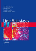 Liver metastases