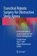 TransOral Robotic Surgery for Obstructive Sleep Apnea