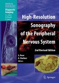 High-resolution sonography of the peripheral nervous system