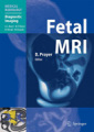 Fetal MRI