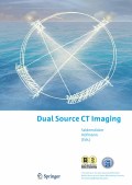 Dual source CT imaging