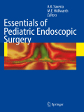 Essentials of pediatric endoscopic surgery