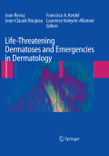 Life-threatening dermatoses and emergencies in dermatology