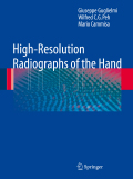 High-resolution radiographs of the hand