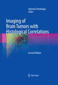 Imaging of brain tumors with histological correlations