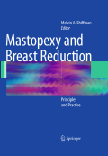 Mastopexy and breast reduction: principles and practice