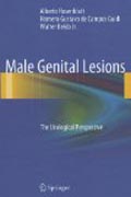 Male genital lesions: the urological perspective