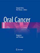 Oral Cancer