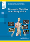 Resonancia Magnética Musculoesquelética