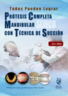 Prótesis Completa Mandibular con Técnica de Succión