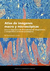 Atlas de imágenes macro y microscópicas para la asignatura de Procedimientos diagnósticos y terapéuticos anatomo-patológicos