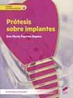 Prótesis sobre implantes