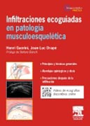 Infiltraciones ecoguiadas en patología musculoesquelética