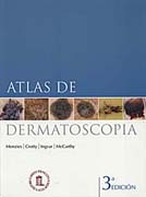 Atlas de dermatoscopia