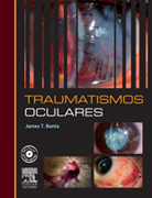 Traumatismos oculares