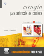 Cirugía para artrosis de cadera