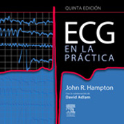 ECG en la práctica