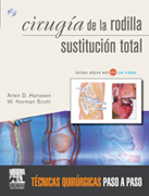 Cirugía la rodilla: sustitución total