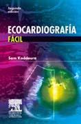 Ecocardiografía fácil