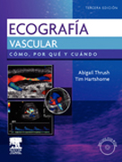 Ecografía vascular: cómo, por qué y cuándo