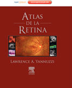 Atlas de la retina