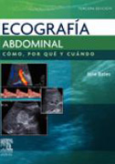 Ecografía abdominal: cómo, por qué y cuándo