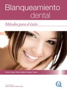 Blanqueamiento Dental: Métodos para el éxito