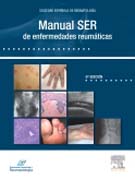 Manual SER de las enfermedades reumáticas