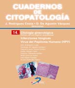 Citología ginecológica: Infecciones fúngicas. Virus del Papiloma Humano