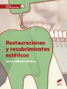 Restauraciones y recubrimientos estéticos