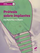 Prótesis sobre implantes