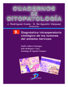 Diagnóstico intraoperatorio citólógico de los tumores del sistema nervioso