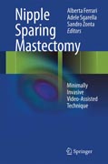 Nipple Sparing Mastectomy