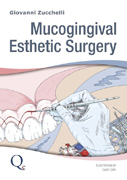 Mucogingival Esthetic Surgery