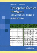 Epilepsias focales benignas: en lactantes, niños y adolescentes